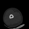 SPORK, NICO - 22.03.1976 - 02.08.2022 - CT obere Extremität - 17:51:17